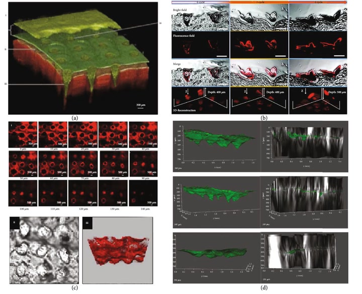 Microscopy and 3D reconstruction of dissolvable microneedle arrays